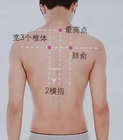 艾灸的20条铁规,一定要知道